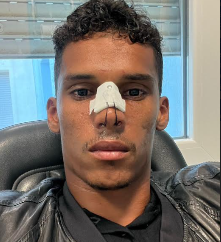 Lesão no nariz